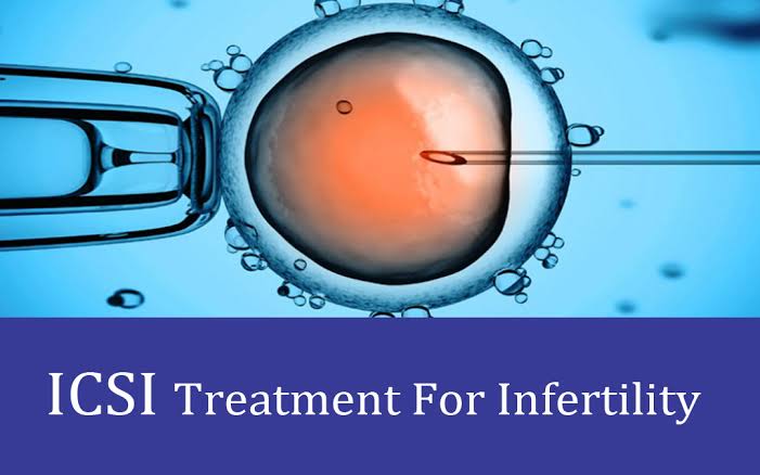 ICSI Treatment in Delhi